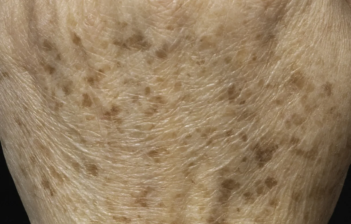 Skin before treatment
