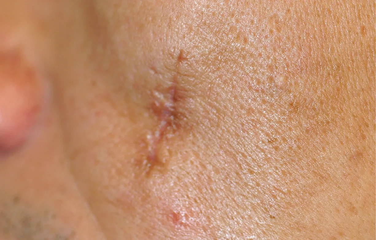 Skin before treatment
