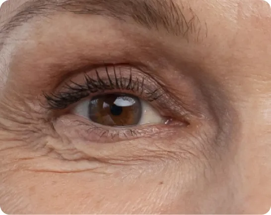 Close-up of an eye with fine wrinkles and crow's feet